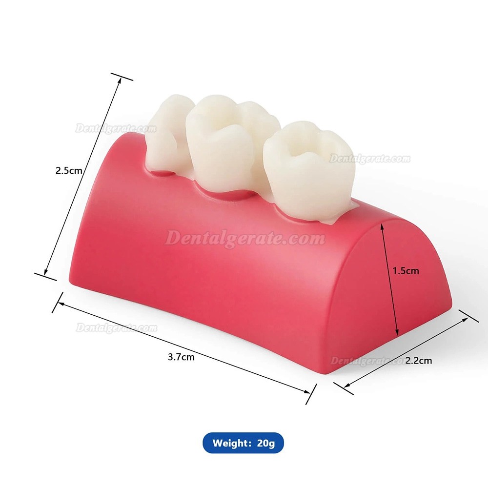 Dental Inlay &Uuml;bungsblock Komposit-Harz F&uuml;llung Z&auml;hne